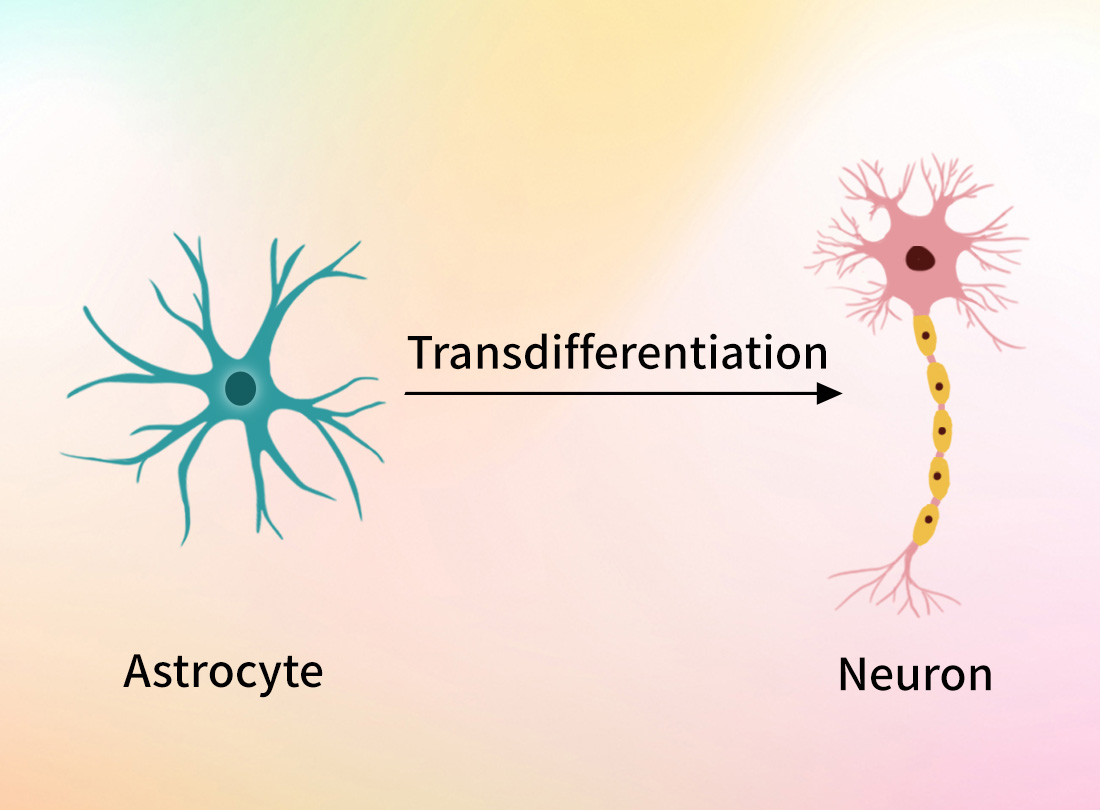 A real breakthrough for Parkinson’s disease?